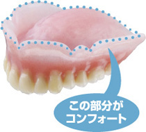 歯ぐきの健康と噛み心地を考えた入れ歯の新技術「コンフォート」